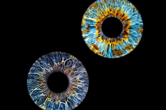 Iris Paar Shooting - 40x40cm auf Echt-Glas, für 2 Personen  