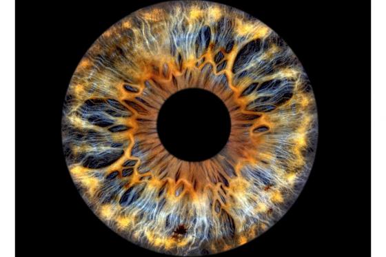 Iris Paar Shooting - 50x50cm auf Leinwand, für 2 Personen 2 